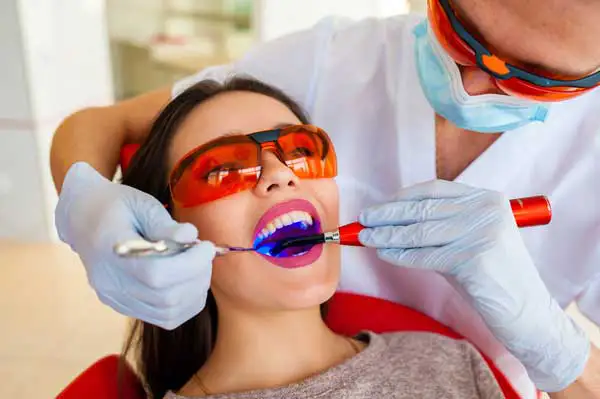 A dentist using a blue curing light to harden a filling while the patient wears protective glasses, highlighting the modern dental filling process.